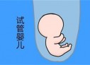 培养东莞捐卵宝宝艺术细胞的小技巧
